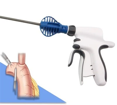 Ultrasonic Scalpel System Abdominal Surgery